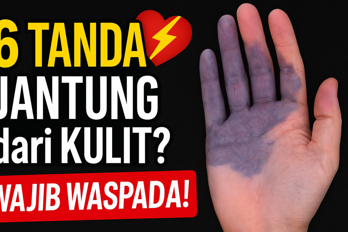 6 Tanda Penyakit Jantung di Kulit yang Harus Diwaspadai Sejak Dini
