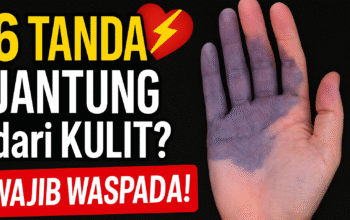 6 Tanda Penyakit Jantung di Kulit yang Harus Diwaspadai Sejak Din